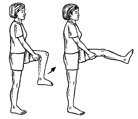 Patellofemoral%20Syndrome04.png