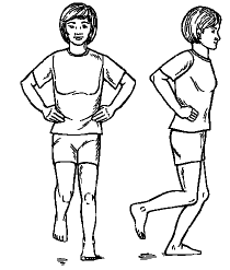 Patellofemoral%20Syndrome06.png